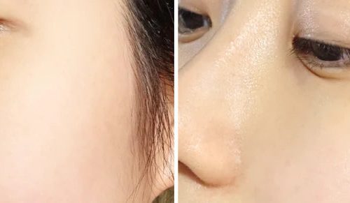 24KMaskbeforeandafter