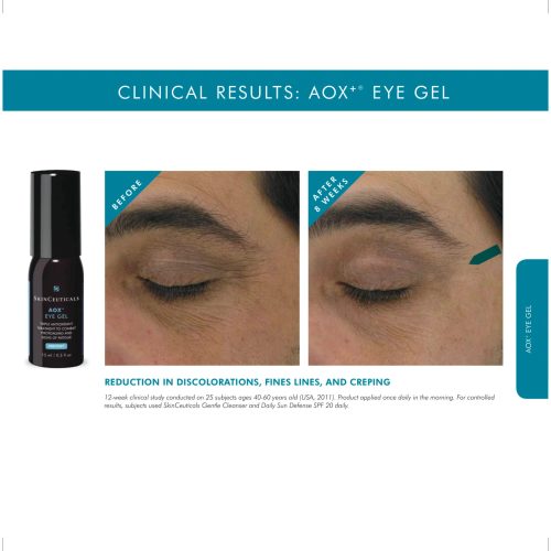 Aox Eye Gel2