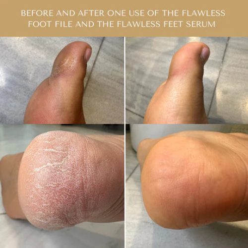 FlawlessFeetSerum2 006223bf fa78 4832 ae1f f0e3550f873a