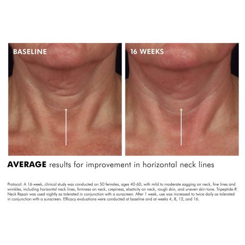 Tripeptide R Neck Repair3