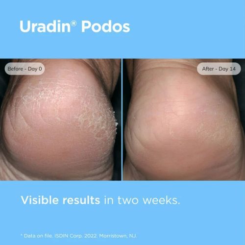 Uradin Podos 3C